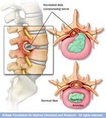 24Seven Wellness & Living Back Pain Relief DVD, Natural Prevention of Lower, Upper, Neck and Sciatic Pain. A Yoga and Pilates Based Stretch Program That Could Potentially Change Your Life!