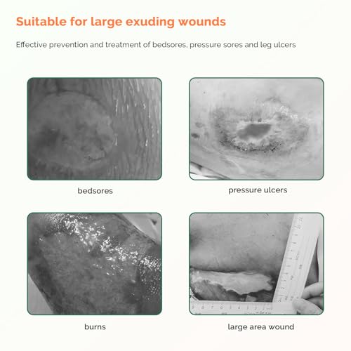 Sacrum Foam Dressing with Border - 7x7 Inch Waterproof 10-Pack for Wound Care
