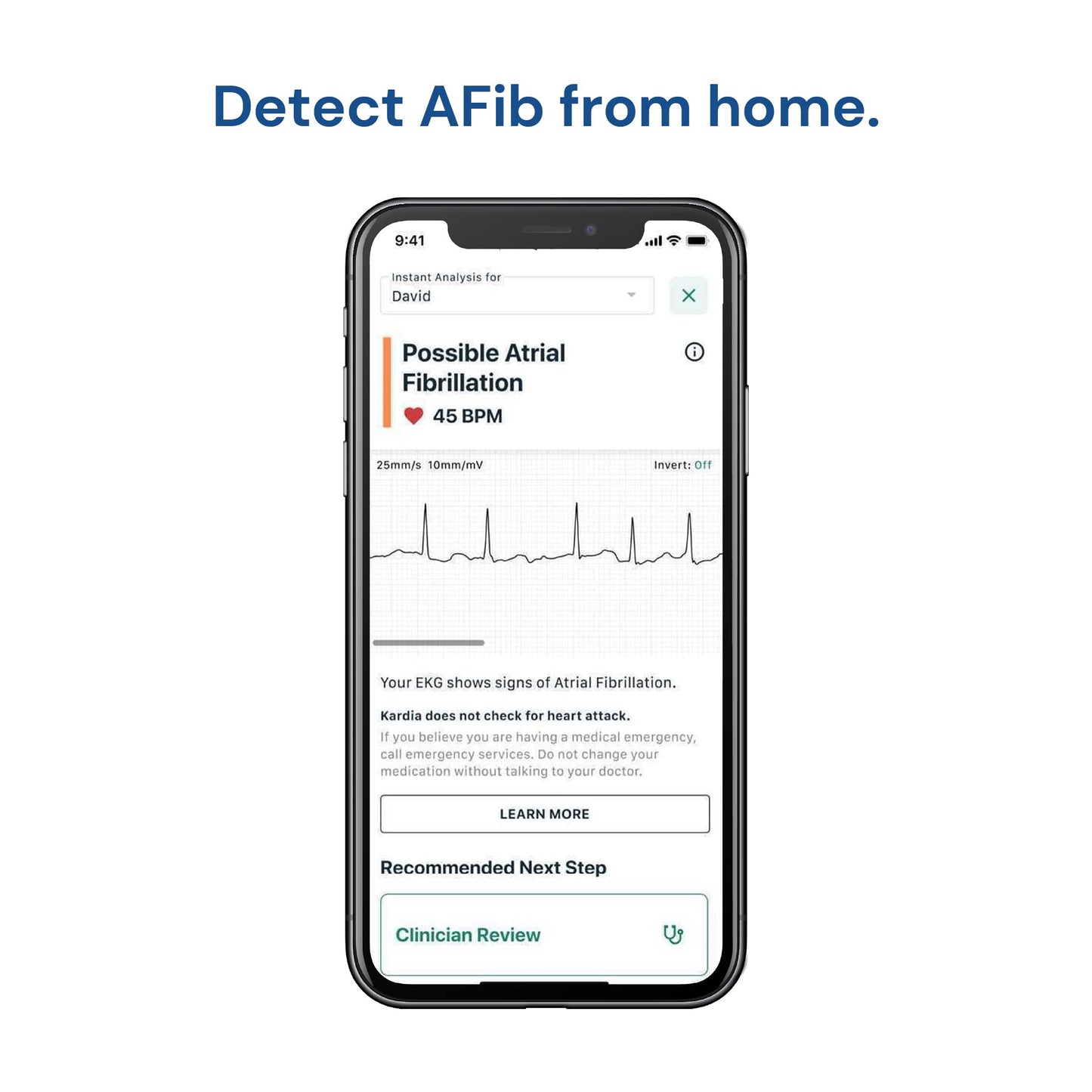 KardiaMobile 1-Lead Personal EKG Monitor – Record EKGs at Home – Detects AFib and Irregular Arrhythmias – Instant Results in 30 Seconds – Easy to Use – Works with Most Smartphones - FSA/HSA Eligible