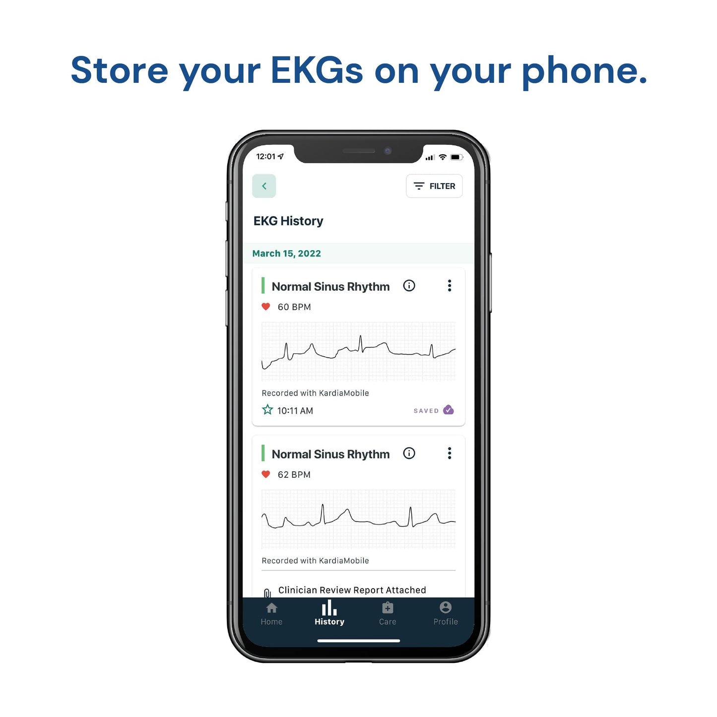 KardiaMobile 1-Lead Personal EKG Monitor – Record EKGs at Home – Detects AFib and Irregular Arrhythmias – Instant Results in 30 Seconds – Easy to Use – Works with Most Smartphones - FSA/HSA Eligible