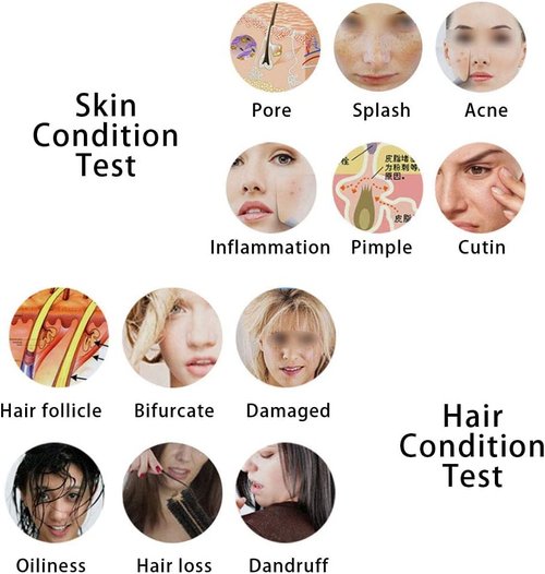 Skin Diagnosis Hair Analyzer, 5 Inch Screen Digital Skin Diagnosis Scanner System, Skin Hair Blackhead Scalp Detector Skin Hair Scalp Detector