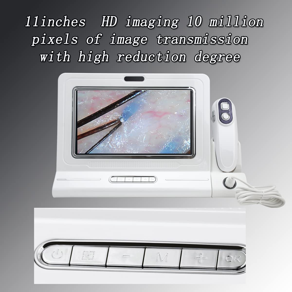 11 Inch LCD Screen Skin Diagnosis Hair Detector Scalp Hair Follicle Moisture Skin Pores Magnifying Analyzer Skin Pigment Tester Portable Rechargeable