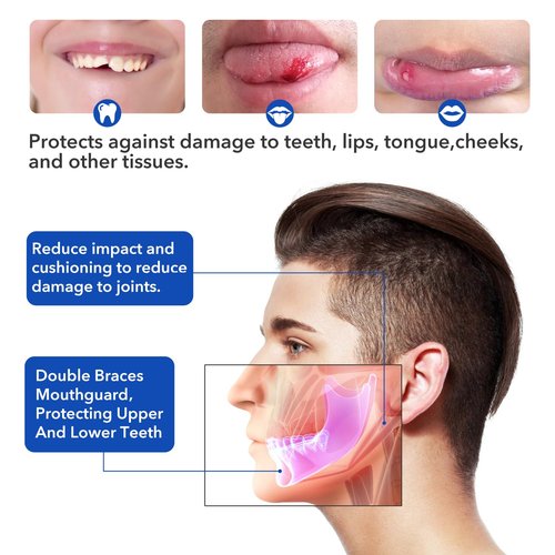 Mouth Guard Sports Youth Adult, Mouthguard for Braces Sparring Mouth Guard,Double Braces, Soft, No Boiling Required, Football, Taekwondo, Jujitsu and Karate.