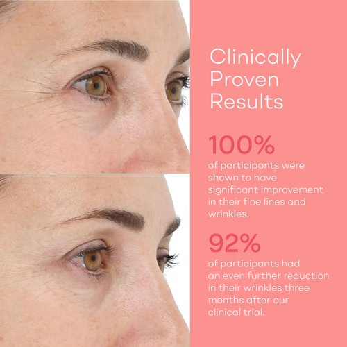 LightStim for Wrinkles LED Red Light Therapy with 72 LEDs (605, 630, 660, & 855 nm Wavelengths). Reduces Fine Lines, Wrinkles, Rejuvenates Skin, and Maintains a Youthful Appearance FDA Cleared White