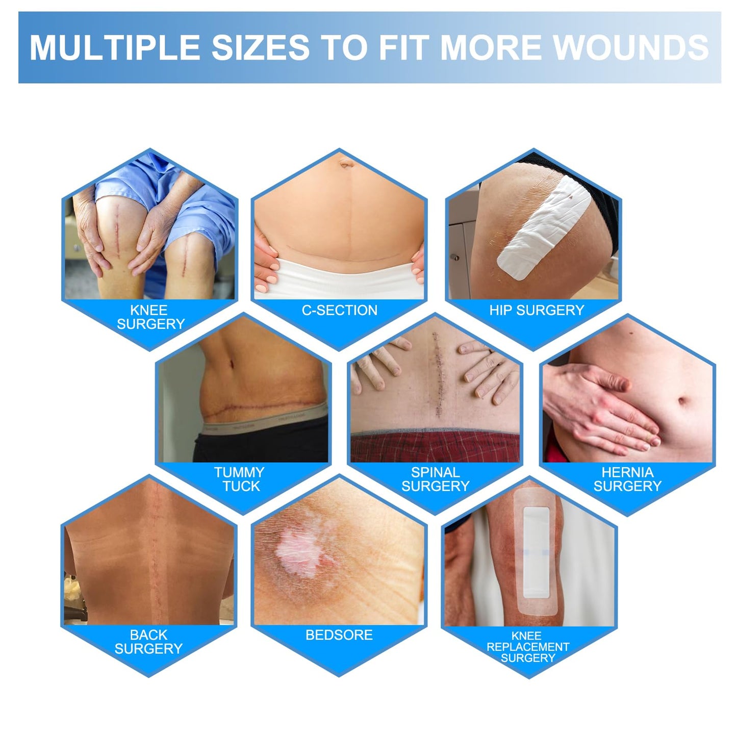 30 Pack 4"x 8" Waterproof Adhesive Island Dressing for Post-Surgery Recovery | Sterile Bordered Gauze Bandages with Non-Stick Pad for Knee/Hip Replacement, Surgical Incision Care & Shower Protection