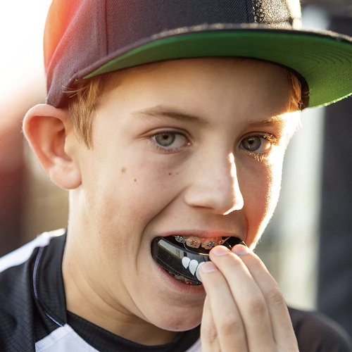 Shock Doctor Orthodontic Mouth Guard for Braces for Sports, Hockey, Lacrosse, Football, Baseball, Braces Mouth Guard, Upper Teeth Protection, Adult & Youth Mouth Guard Sizes