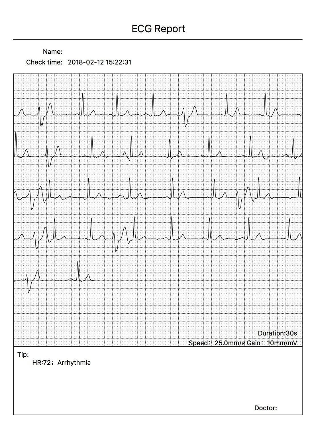 CONTEC Portable ECG/EKG Monitor PC Software Electrocardiogram Bluetooth Heart Rate Beat LCD Monitor PM10