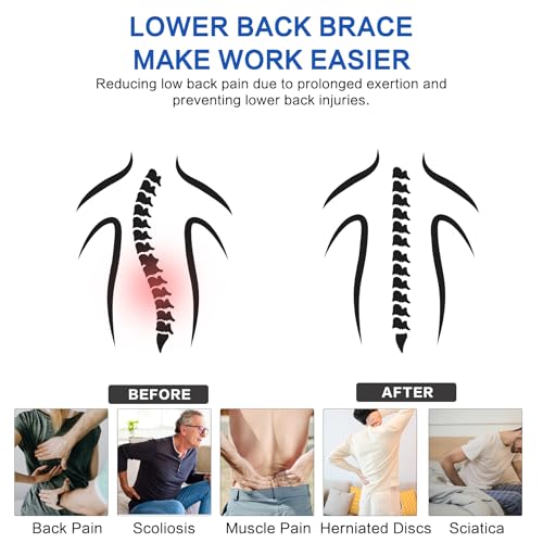 Back Brace Support Belt For Men & Women, Lumbar Support Belt Relief for Upper and Lower Back Pain , Sedentariness ,Sciatica£¬Scoliosis and Herniated Disc -Adjustable Breathable Back Brace Suitable For Home, Fitness, Driving, Work,Travel-Black(Medium)