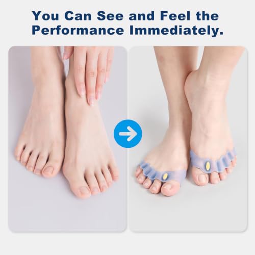 Progressive Big Toe Separators Gel Bunion Corrector for Hammer & Claw Toe - Blue with Hole Plug