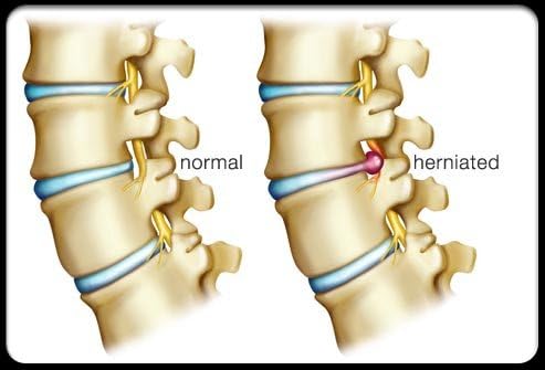 24Seven Wellness & Living Back Pain Relief DVD, Natural Prevention of Lower, Upper, Neck and Sciatic Pain. A Yoga and Pilates Based Stretch Program That Could Potentially Change Your Life!