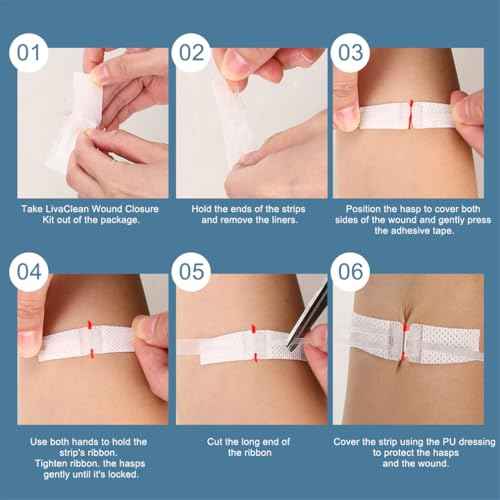 Wound Closure Strips 3PCS Butterfly Wound Closure Suture Strip Butterfly Bandages Butterfly Bandages Emergency Laceration Closure Kit for Lacerations Incisions Cuts