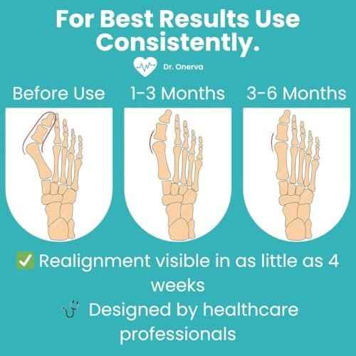 2PC Bunion Corrector for Women & Men ? Toe Straightener Socks for Hallux Valgus, Pain Relief, Non-Slip, Breathable, Day & Night Use, Washable, L/R Foot Set