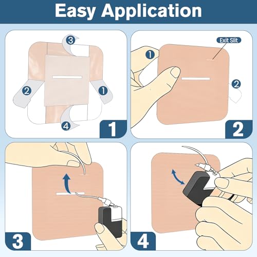 Waterproof Adhesive Patches for Insulin Pump - 40 Beige Hypoallergenic & Breathable