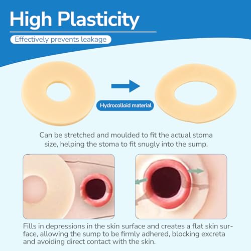 Ostomy Barrier Ring 10PCS Thick 4mm Moldable Hydrocolloid 48mm - Variation of THIS Listing