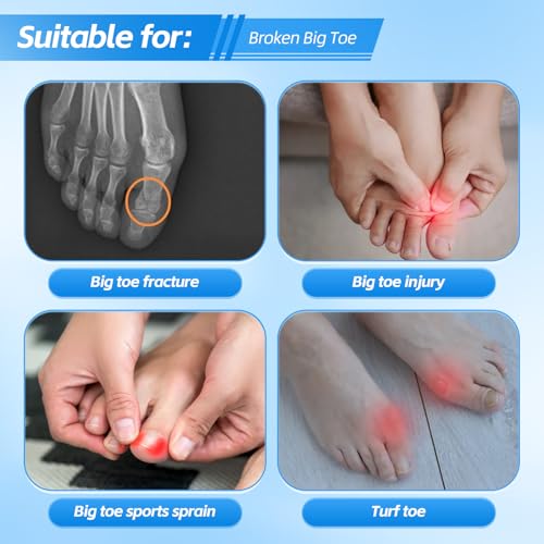 Broken Big Toe Splint Brace, Turf Toe Brace Support for Broken, Fracture, Sprains, Arthritis, Women & Men, with 2 Detachable Metal Plates - Right
