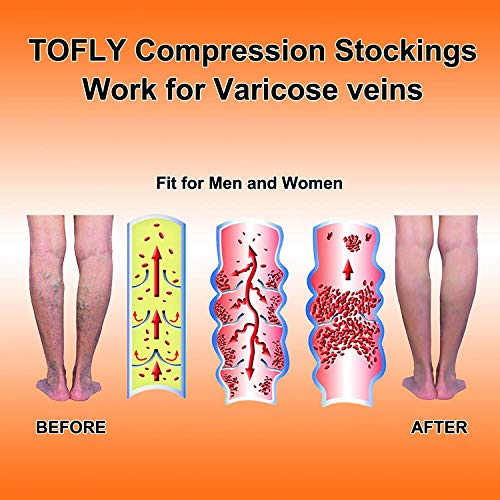 Pink Calf Compression Sleeves 20-30mmHg Support for Men & Women - Medium