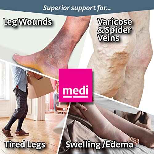 mediven Plus for Men & Women, 30-40 mmHg ? Open Toe, Knee High Compression Socks with Silicone Top Band