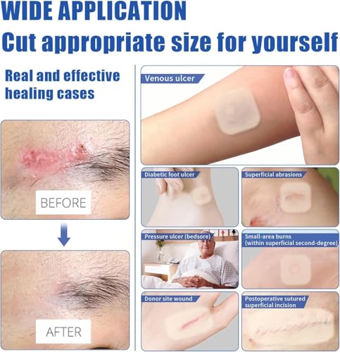 Hydrocolloid Bandages 2x2 Inches - Waterproof Self-Adhesive Wound Dressings, 10 Packs (Variation: 2IN*2IN-10 PCS)