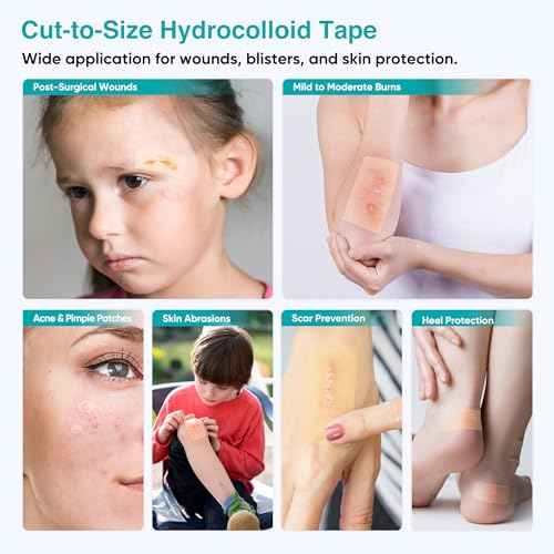 Derm Tape Hydrocolloid Roll - Acne & Pimple Patch Tape, Flexible Bandages Roll for Wound Care and Skin Protection, Cut-to-Size Hydrocolloid Tape for Daily Use (2in x 16ft)