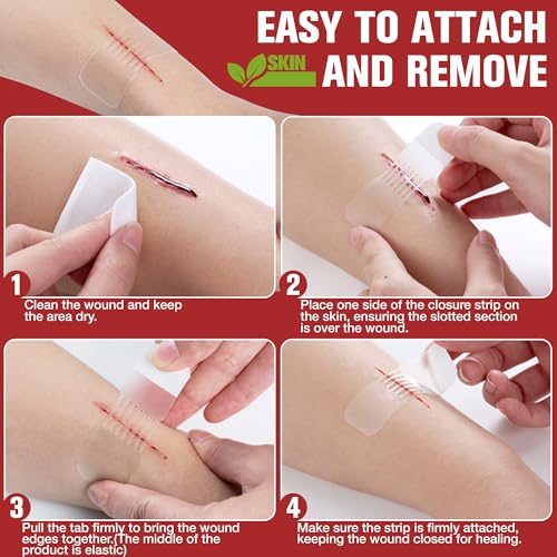Emergency Wound Closure Strips - 4PCS Dotodo First Aid Kit - Waterproof & Hypoallergenic