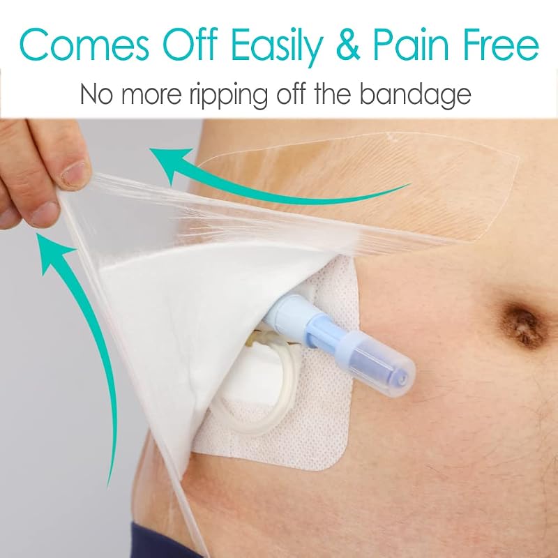 Waterproof Shower Cover with Non-Stick Center Pad (6x6 inch, Pack of 25) for Post-Surgery Wounds