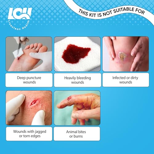 43 Pack Wound Closure Strips Kit with Butterfly Bandages Gauze Dressings and Swabs - Emergency First Aid Supplies