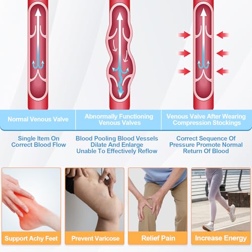 XL Thigh High Compression Stockings for Men and Women 15-20 mmHg Anti-Embolism