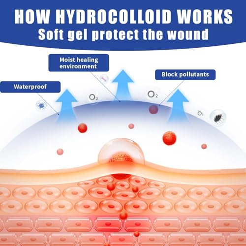 Hydrocolloid Bandages 2x2 Inches - Waterproof Self-Adhesive Wound Dressings, 10 Packs (Variation: 2IN*2IN-10 PCS)