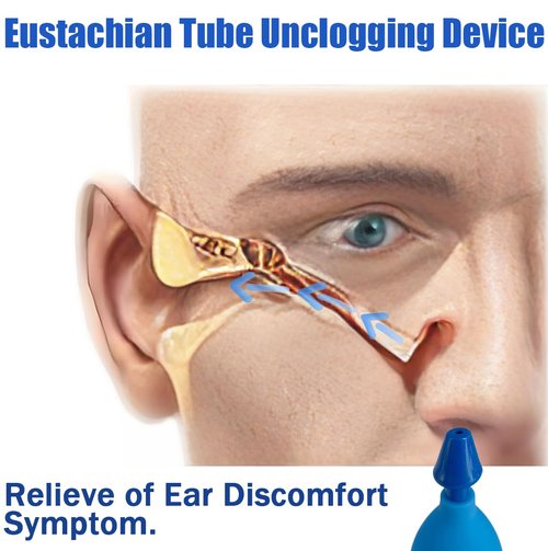 nsgglecher Ear Congestion Tinnitus Ear Ache Relief, Eustachian Tube Unclogger,Ear Pressure Relief Device,Safely & Naturally Eustachian Tube Exerciser
