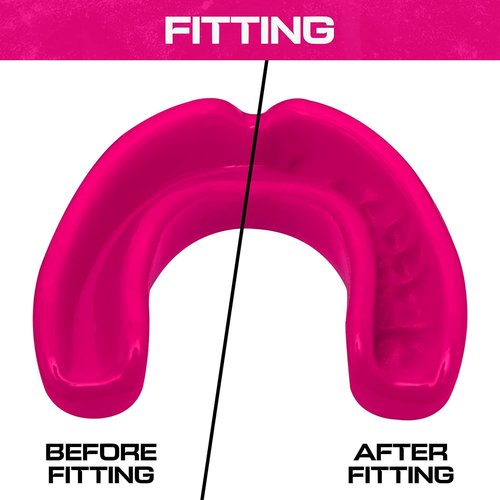 BFS IMPEX Sports Mouth Guard for Kids,Youth,Boys,Girls,Child Teen Mouthguard with Case (BPA Free) for Boxing, Martial Arts,MMA Karate,Lacrosse,Football,Soccer and All Contact Sports (Pink)