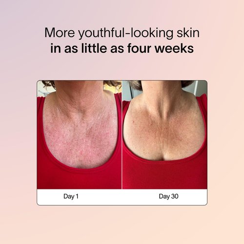 Solawave Red Light Therapy Mask for Neck & Chest | Red Light & Near Infrared Light Device for Décolleté | Rejuvenates the Skin, Smooths Look of Fine Lines & Wrinkles | Anti-Aging Skincare at Home