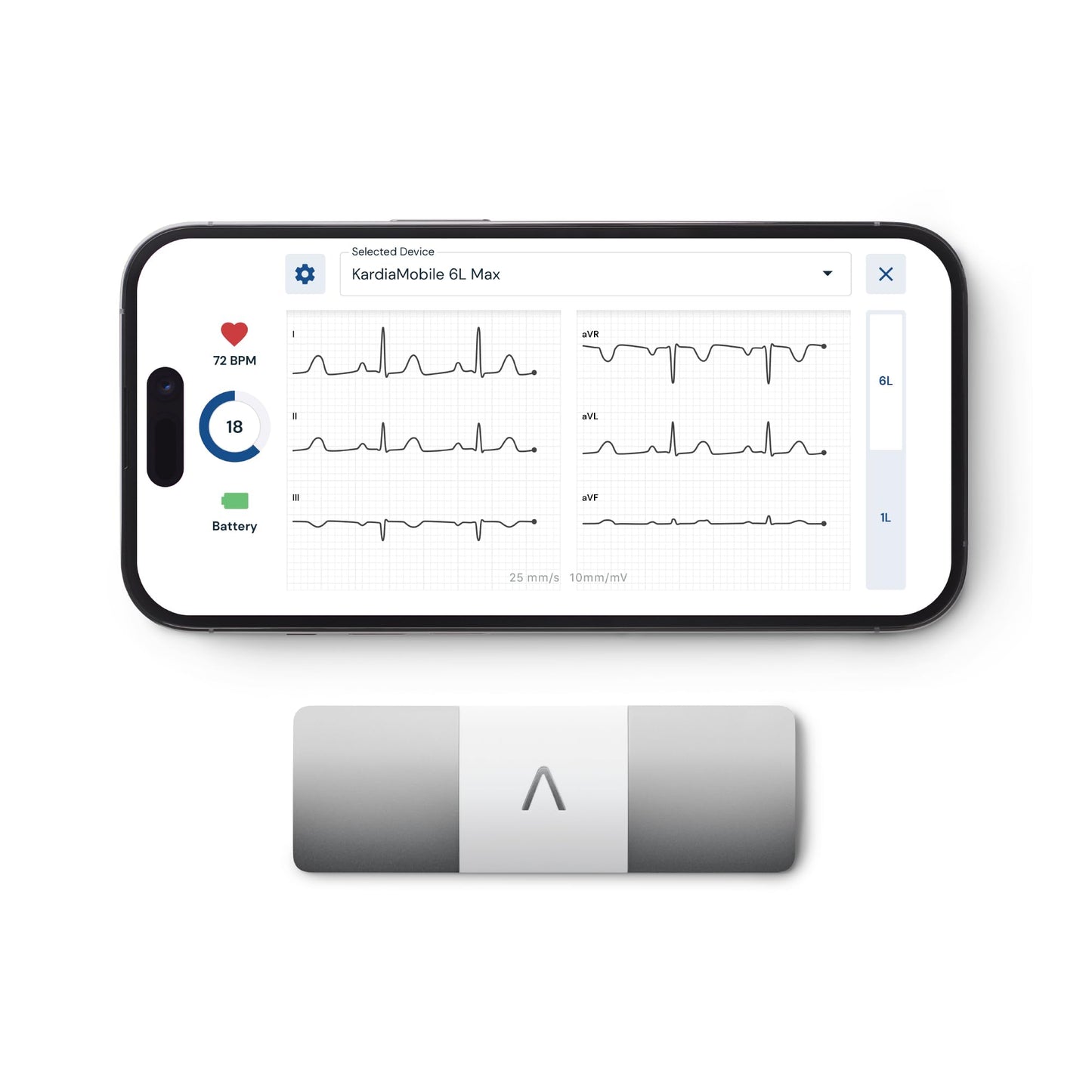 KardiaMobile 6L Max with 12-Month Subscription | 6-Lead Personal EKG Monitor | Heart Health Membership | Detects AFib & Irregular Arrhythmias | Easy Results in 30 Seconds | Works with Smartphones