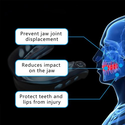 KLASHE Kids Sports Mouthguard Football Mouth Guard, 2 Pack with Case and Strap Mouth Guard Football, 1.7 x 1.96 inches, for Boxing, Basketball, Hockey, Ages 4-8