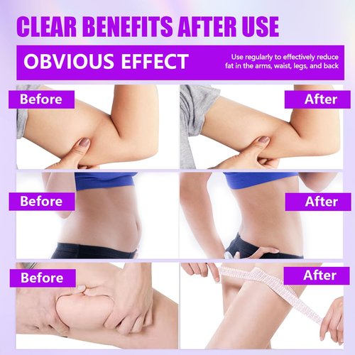 Thigh Master,Kegel Exerciser,Pelvic Floor Muscle,Pelvic Floor Exercise Devices,Thigh Master Thigh Exerciser for Women,Hip Trainer Kegel Exerciser,Pelvic Floor Trainer for Postpartum Rehabilitation