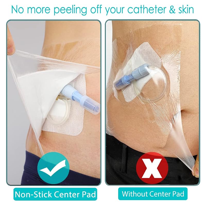 Waterproof Dialysis Port Shower Cover Kit with Central Pad 6x6 Inch – Pack of 25 (With Central Pad)