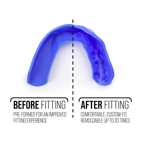 SISU 3D Mouthguard, Snow White - 2.0mm Thin - for Athletes Over 5’ Tall - Pre-Formed for Custom-Molded Fit - Remoldable Up to 20 Times - Non Toxic