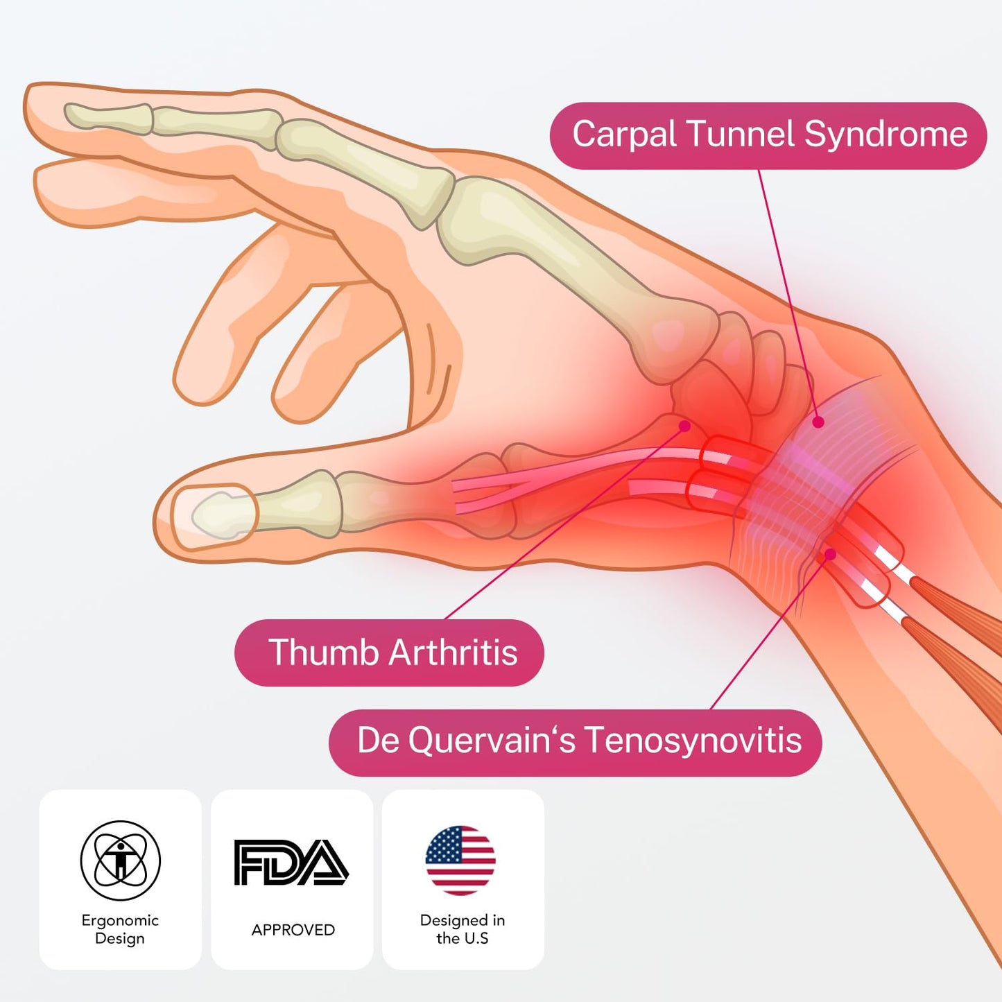 Fitomo Wrist Brace & Thumb Stabilizer, Carpal Tunnel, De Quervain's Tenosynovitis, Tendonitis, Arthritis Support, Thumb Splint for Pain Relief, Women and Men (Left Hand, L/XL)
