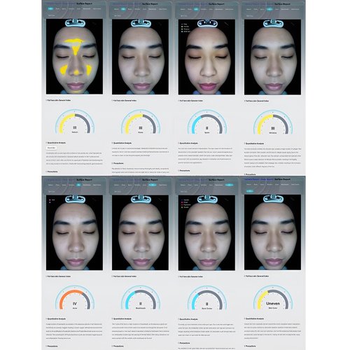 Professional Skin Analyzer Machine - JXUANMM Facial Skin Detection & Analysis Professional Dermatoscope Intelligent Moisture Analyzers Instrument for Healthy Skin Care,White-MJ-13.3in