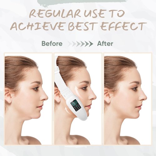 Cteart V-Face Electric Double Chin Device with 8 Modes & 15 Gear Adjustable Intensities - Intelligent V-Face Machine for Contouring Double Chin - H092