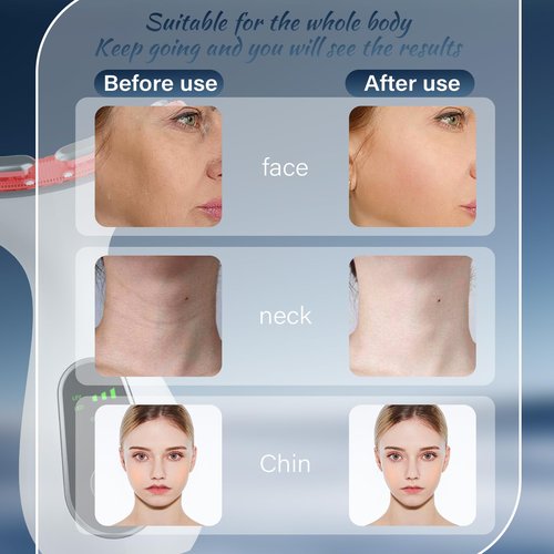 HOTORMER Face Massager Tool, Facial and Neck Massager Beauty 3-in-1 Triple Action Light, Thermal, and Vibration for Skin Care Face Sculpting Tool (White)