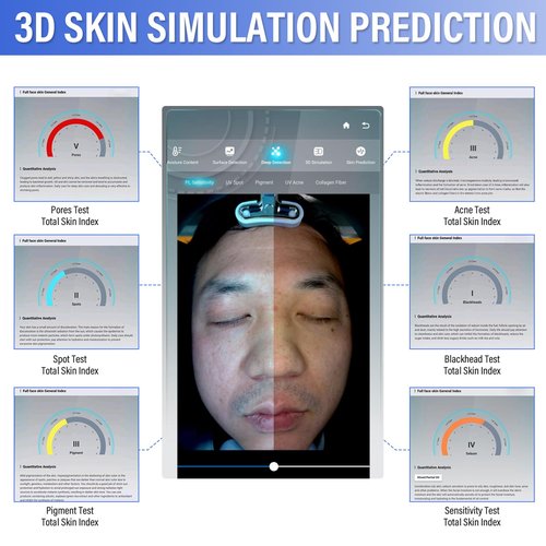 HNZXIB 13.3 Inch Skin Analysis Machine, 38MP AI Facial Skin Analyzer, 8 Spectral Skin Analyzer Machine, Moisture Detector for Beauty Salon & Home, Multi-Language Support