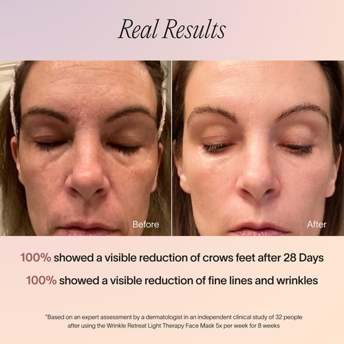 Solawave Red Light Therapy Mask for Face | Red & Near-Infrared Led Light Device | Reduces Appearance of Fine Lines & Wrinkles | Improves Firmness, Elasticity, & Texture | 10-Min Anti-Aging Treatment