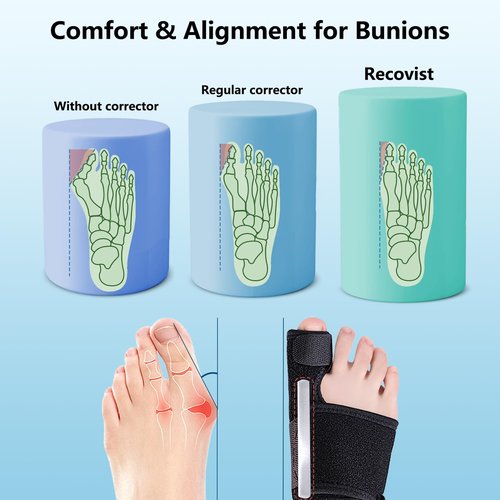 Deedlite Recovist Bunion Brace for Women & Men, Bunion Corrector Big Toe Straightener, Reduce Pain Correct Toe Alignment for Left & Right Foot (A, Black, 1 Pair)