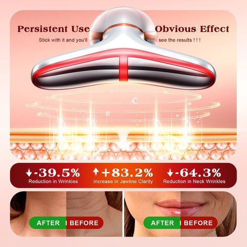 Pedete Facial Massager, 7 Colors Red Light Therapy for Face and Neck, Face Lift Device with 113°F Heating Vibration for Multi Skin Care