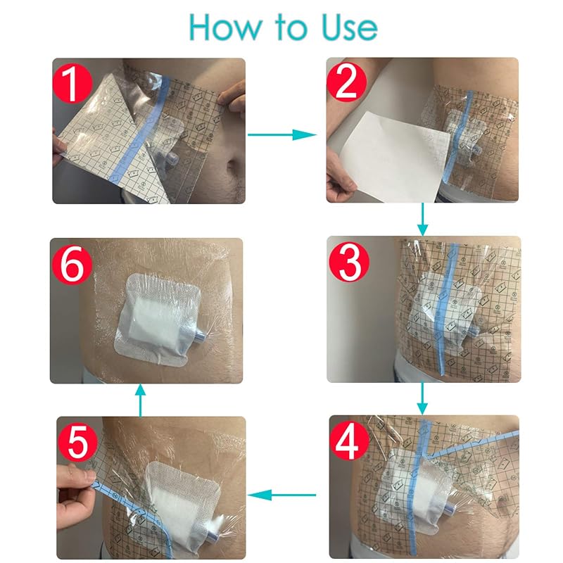 Waterproof Shower Cover with Non-Stick Center Pad (6x6 inch, Pack of 25) for Post-Surgery Wounds