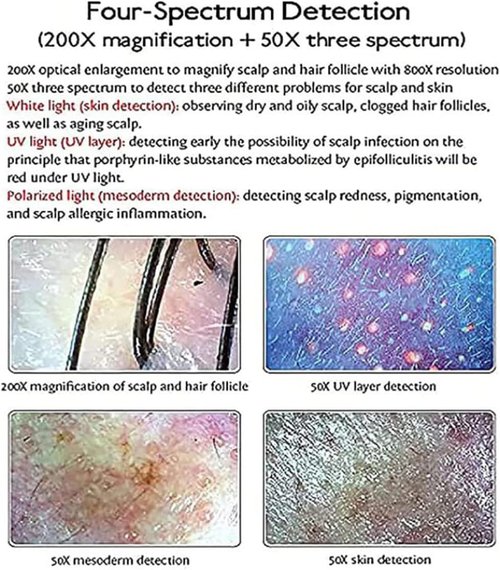 ZXSYYDS Skin Hair Scalp Detector Analyzer,15inch LCD Screen Digital Skin Detector, Multifunctional Scalp Detector Machine, Rechargeable Hair Follicle Skin Analyser Machine