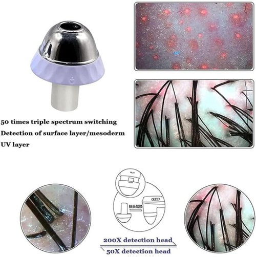 ZXSYYDS Skin Hair Scalp Detector Analyzer,15inch LCD Screen Digital Skin Detector, Multifunctional Scalp Detector Machine, Rechargeable Hair Follicle Skin Analyser Machine