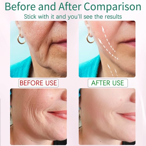 Whsdo 7-in-1 Red-Light-Therapy-for-Face and Neck, Face Neck Massager for Daily Skin Care Routine