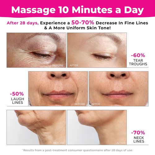 Facial Massager, Red Light Therapy for Face and Neck, Face Lift Device for Skin Care, Self Care Microcurrent Facial Device, Lymphatic Drainage Massager, True Beauty Glow Sculptor Double Chin Gha Sha