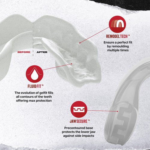 SAFEJAWZ Sports Mouthguard Slim Fit, Adult and Junior Mouth Guard with Case for Boxing, Basketball, Lacrosse, Football, MMA, Martial Arts, Hockey and All Contact Sports (Adult 12+ Years, Clear)